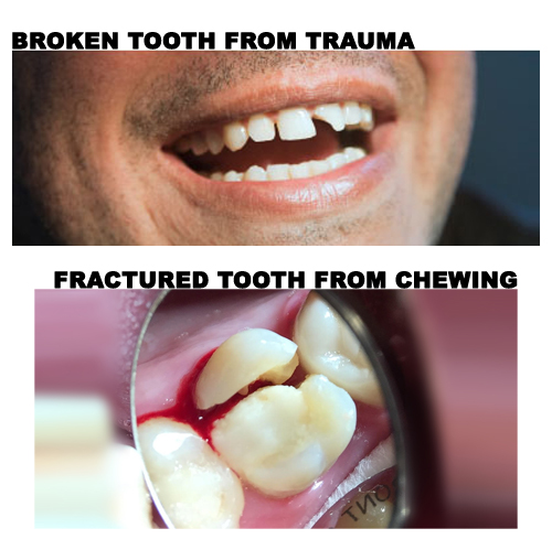 Emergency Dentistry